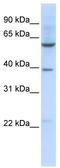 Solute Carrier Family 35 Member F3 antibody, TA334615, Origene, Western Blot image 