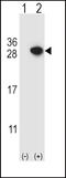 Rho GDP Dissociation Inhibitor Alpha antibody, 61-586, ProSci, Western Blot image 