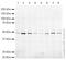 Tumor Susceptibility 101 antibody, ab30871, Abcam, Western Blot image 