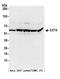 Chaperonin Containing TCP1 Subunit 4 antibody, A304-726A, Bethyl Labs, Western Blot image 