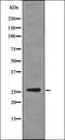 Insulin Receptor antibody, orb335676, Biorbyt, Western Blot image 