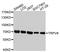 Transient Receptor Potential Cation Channel Subfamily V Member 6 antibody, A1495, ABclonal Technology, Western Blot image 