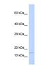 Ninjurin-1 antibody, NBP1-59210, Novus Biologicals, Western Blot image 