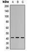 Vacuolar Protein Sorting 72 Homolog antibody, LS-C368637, Lifespan Biosciences, Western Blot image 