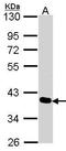 PDZ And LIM Domain 4 antibody, GTX106353, GeneTex, Western Blot image 