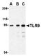 Toll Like Receptor 9 antibody, orb108993, Biorbyt, Western Blot image 