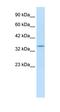 Potassium Voltage-Gated Channel Subfamily A Regulatory Beta Subunit 2 antibody, orb324607, Biorbyt, Western Blot image 