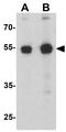 Purinergic Receptor P2X 7 antibody, GTX31600, GeneTex, Western Blot image 