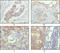 Activated Leukocyte Cell Adhesion Molecule antibody, M01788-1, Boster Biological Technology, Immunohistochemistry paraffin image 