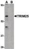 Tripartite Motif Containing 25 antibody, PA5-20410, Invitrogen Antibodies, Western Blot image 