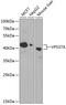 VPS37A Subunit Of ESCRT-I antibody, 15-402, ProSci, Western Blot image 