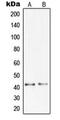 Progastricsin antibody, MBS820734, MyBioSource, Western Blot image 