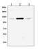 Protein Tyrosine Kinase 2 antibody, PA1574, Boster Biological Technology, Western Blot image 