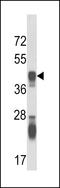 Argininosuccinate Synthase 1 antibody, LS-B10705, Lifespan Biosciences, Western Blot image 