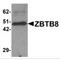Zinc Finger And BTB Domain Containing 8A antibody, MBS150061, MyBioSource, Western Blot image 