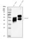 RAGE antibody, PA1069, Boster Biological Technology, Western Blot image 