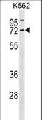 Cyclin K antibody, LS-C168481, Lifespan Biosciences, Western Blot image 