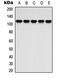 ATPase Na+/K+ Transporting Subunit Alpha 2 antibody, LS-C368564, Lifespan Biosciences, Western Blot image 