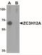 Zinc Finger CCCH-Type Containing 12A antibody, NBP1-76258, Novus Biologicals, Western Blot image 