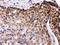 Interferon Regulatory Factor 5 antibody, PA5-79518, Invitrogen Antibodies, Immunohistochemistry paraffin image 