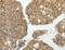 G Protein-Coupled Receptor Kinase 4 antibody, LS-C404030, Lifespan Biosciences, Immunohistochemistry paraffin image 