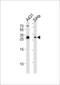 Hydroxysteroid 17-Beta Dehydrogenase 12 antibody, LS-C165033, Lifespan Biosciences, Western Blot image 