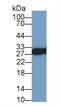 VAMP Associated Protein A antibody, MBS2001849, MyBioSource, Western Blot image 
