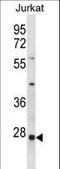 HIV-1 Tat Interactive Protein 2 antibody, LS-C165078, Lifespan Biosciences, Western Blot image 