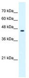 Zinc finger protein GLIS3 antibody, TA345561, Origene, Western Blot image 