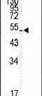 Kruppel Like Factor 5 antibody, PA5-14228, Invitrogen Antibodies, Western Blot image 