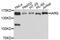 Isoleucyl-TRNA Synthetase antibody, A10190, ABclonal Technology, Western Blot image 