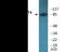 Signal Transducer And Activator Of Transcription 4 antibody, EKC1969, Boster Biological Technology, Western Blot image 