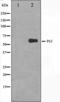 Tumor Protein P63 antibody, orb224530, Biorbyt, Western Blot image 