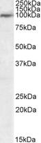 VHL-interacting deubiquitinating enzyme 2 antibody, PA5-18167, Invitrogen Antibodies, Western Blot image 