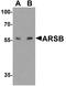 Arylsulfatase B antibody, A01609, Boster Biological Technology, Western Blot image 