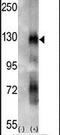 EPH Receptor A6 antibody, PA5-14585, Invitrogen Antibodies, Western Blot image 