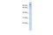 Zinc Finger And BTB Domain Containing 49 antibody, A14333, Boster Biological Technology, Western Blot image 