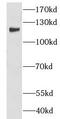 CCR4-NOT Transcription Complex Subunit 3 antibody, FNab01808, FineTest, Western Blot image 