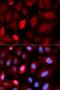 PDZ And LIM Domain 5 antibody, LS-C334242, Lifespan Biosciences, Immunofluorescence image 