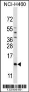 SMCP antibody, 56-673, ProSci, Western Blot image 