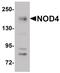 NLR Family CARD Domain Containing 5 antibody, PA5-21017, Invitrogen Antibodies, Western Blot image 