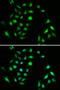 Component Of Inhibitor Of Nuclear Factor Kappa B Kinase Complex antibody, 18-473, ProSci, Immunofluorescence image 