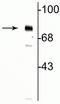 Methyl-CpG Binding Protein 2 antibody, P00047-1, Boster Biological Technology, Western Blot image 