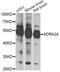 Adrenoceptor Alpha 2A antibody, LS-C748957, Lifespan Biosciences, Western Blot image 