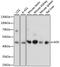 Adenosine Kinase antibody, A15023, ABclonal Technology, Western Blot image 