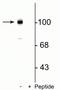 Glutamate Metabotropic Receptor 7 antibody, P05202, Boster Biological Technology, Western Blot image 