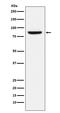 Minichromosome Maintenance Complex Component 5 antibody, M03642, Boster Biological Technology, Western Blot image 