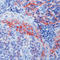 Integrin Subunit Beta 1 antibody, LS-C87525, Lifespan Biosciences, Immunohistochemistry paraffin image 