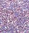 Cbfa1 antibody, GTX81326, GeneTex, Immunohistochemistry paraffin image 
