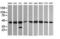 Mitogen-Activated Protein Kinase Kinase 1 antibody, LS-C174644, Lifespan Biosciences, Western Blot image 